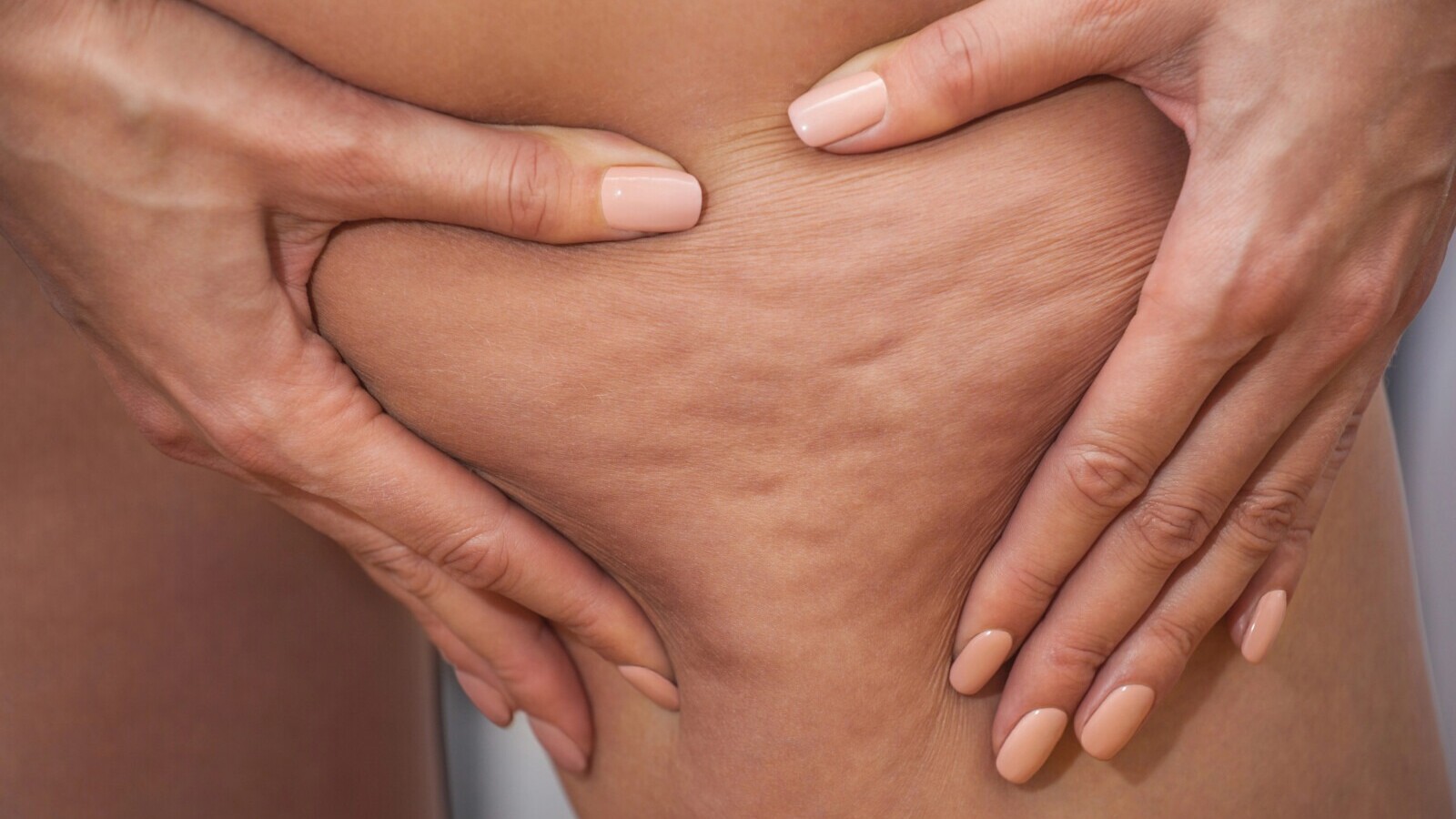 drainage lymphatique et cellulite - traitement Arcachon